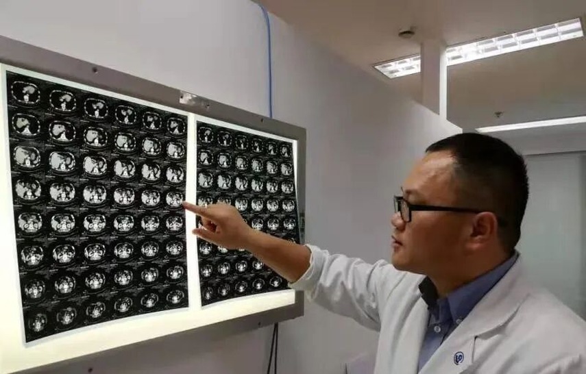 Dr. Li Guichao | Radiation Oncology, and a Peach Blossom Spring in the Heart